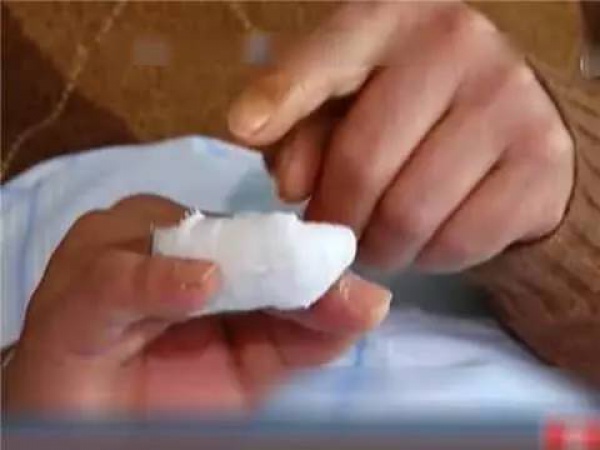后怕！小伙擠個痘痘，擠出高燒、眼睛肺部嚴(yán)重感染送進(jìn)醫(yī)院…你可能也經(jīng)常這樣做
