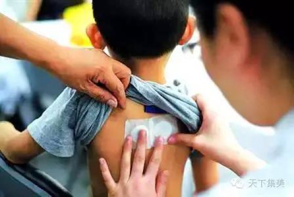 又到一年“三伏灸”，市二院今起開始預(yù)約，還有這些地方可約！