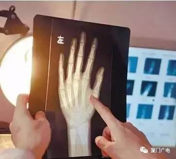 孩子天天跳繩就能長高？醫生說：跳錯了！這個方法才能真正長得高！