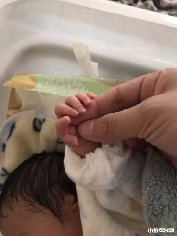 福建一產婦孕期產檢全正常，嬰兒生下來后卻發(fā)現(xiàn)有6種畸形！關于產檢，這些你必須知道！