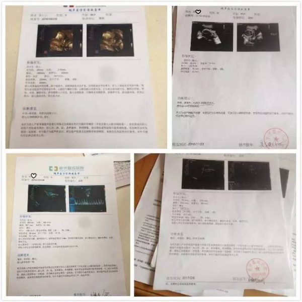 福建一產婦孕期產檢全正常，嬰兒生下來后卻發(fā)現(xiàn)有6種畸形！關于產檢，這些你必須知道！