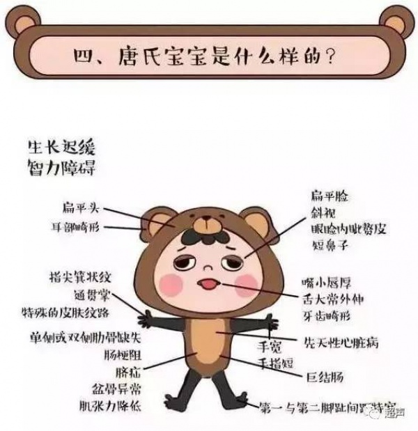 福建一產婦孕期產檢全正常，嬰兒生下來后卻發(fā)現(xiàn)有6種畸形！關于產檢，這些你必須知道！