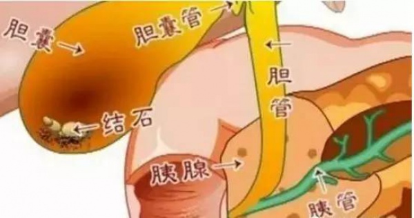 30多歲切除膽囊，原北大醫院院長：這些習慣很要命！年輕人幾乎條條都中