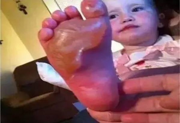 廣場(chǎng)上就碰了一下這東西，三歲女孩立馬倒地身亡……家長(zhǎng)一定要當(dāng)心！