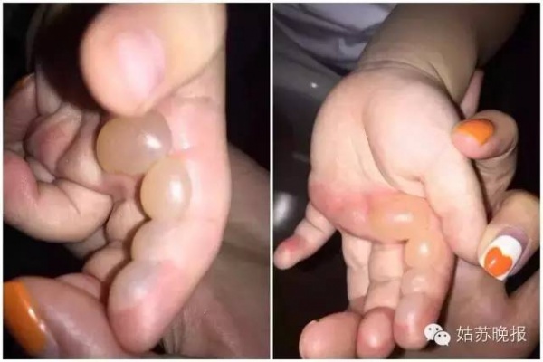 廣場(chǎng)上就碰了一下這東西，三歲女孩立馬倒地身亡……家長(zhǎng)一定要當(dāng)心！